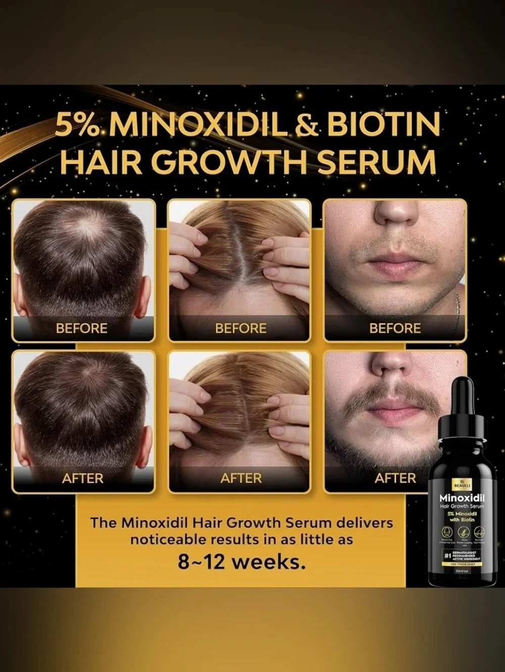 Beaueli Minoxidil 5% Hair Regrowth Treatment Kit For Men and Women